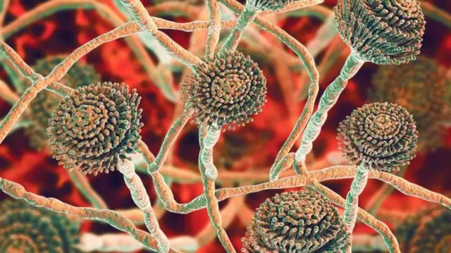 બીબીસી ગુજરાતી, ગુજરાત, બીબીસી, ઓરી, રોગ, દુનિયા જહાન