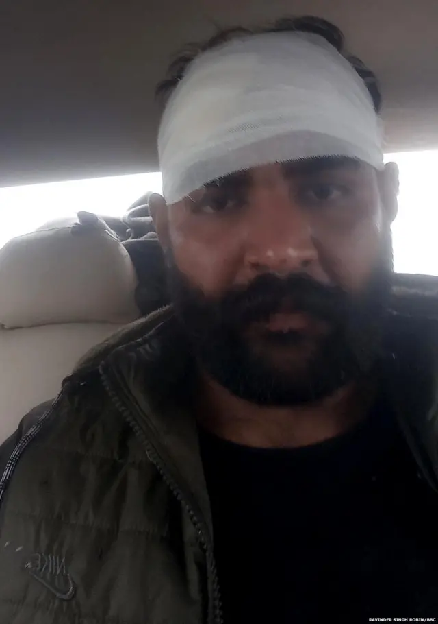 ਵੋਟਿੰਗ ਦੌਰਾਨ ਝੜਪ