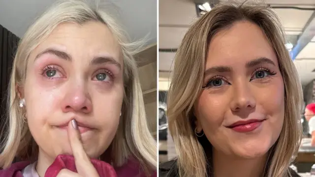 Foto dividida de Lily, de 31 años, rubia y de ojos azules. A la izquierda, su rostro está manchado de lágrimas y no lleva maquillaje. A la derecha, sonríe y lleva maquillaje.