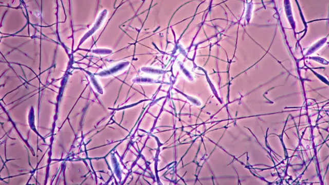 곰팡이에 있는 매우 가는 섬유인 균사체는 액세서리용 소재로 많이 사용되고 있다