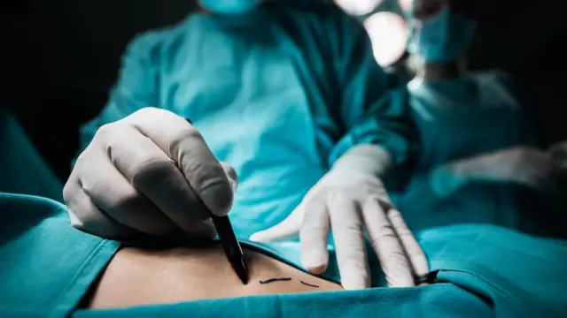 Cirujano operando.
