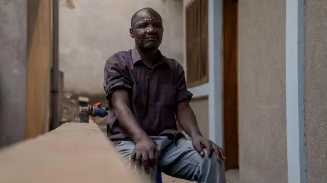 فرد مبتلا به ام پاکس