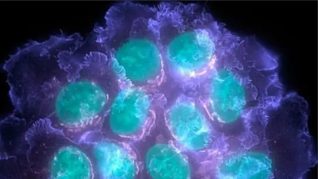 புற்றுநோய்