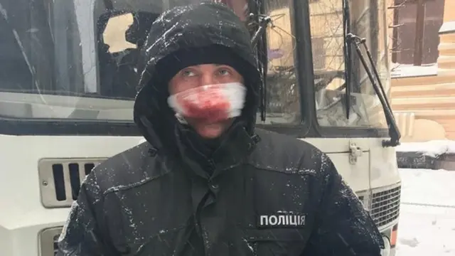 постраждалий