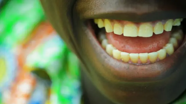 Pesin wey dey shine teeth