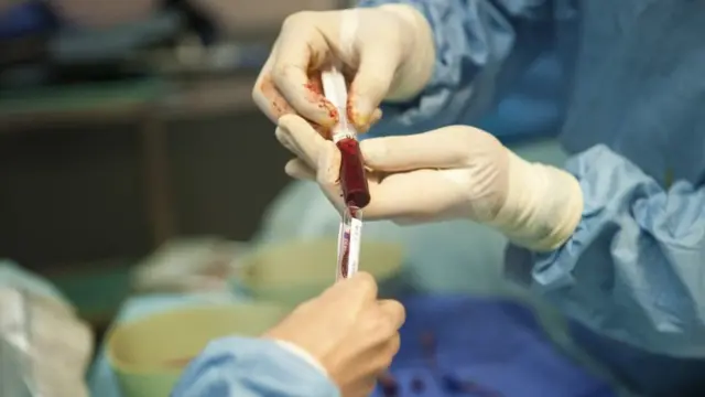 Пересадка кісткового мозку