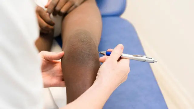 Revisión médica a un menor con parálisis cerebral