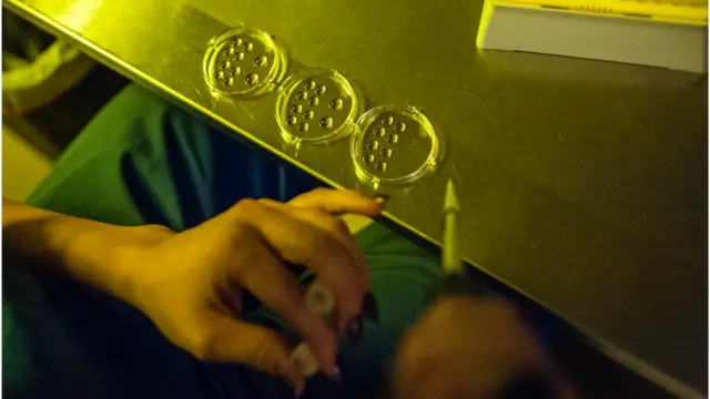 ডিম্বাণু সংরক্ষণ