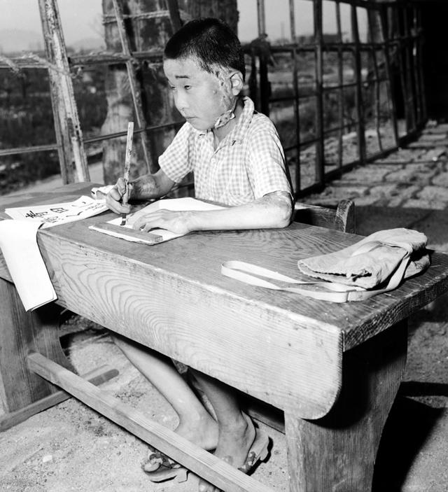 1946年，一个学生在上课，原子弹给他留下了永久的伤疤。