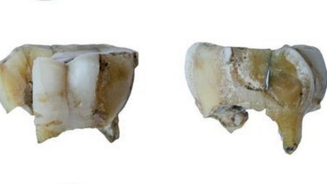 Зуб, по которому ученые вычислили предка индейцев