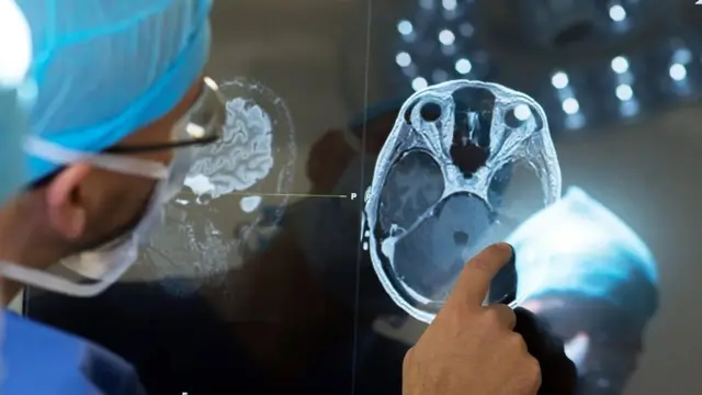 Стимуляція мозку під час "операції у свідомому стані"