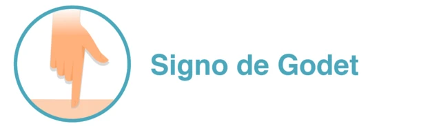 Signo de Godet