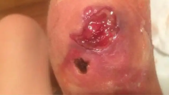 অস্ট্রেলিয়া