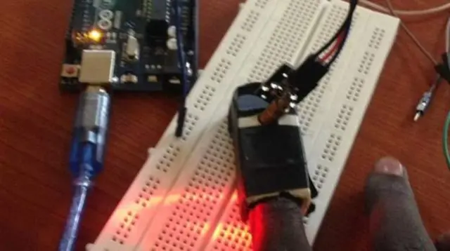 Le détecteur de paludisme de Torpout Nyarikjor.