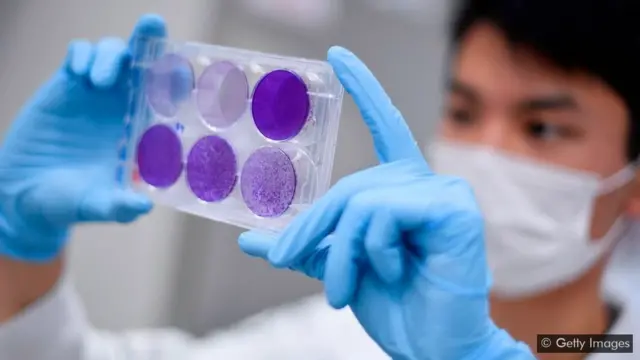 دانشگاه آکسفورد در مرحله بعدی آزمایش، واکسن کرونا را به داوطلبانی از برزیل تزریق خواهد کرد. برزیل از جمله کشورهایی است که بیشترین موارد ابتلا به ویروس کرونا در جهان را دارد.