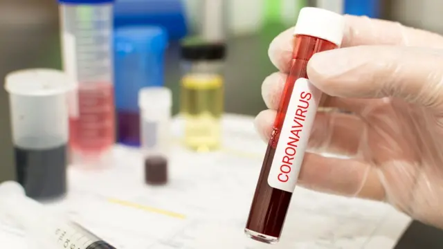 கொரோனா வைரஸ்