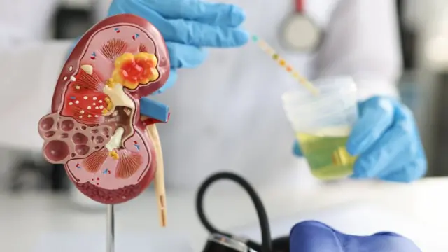 ਗੁਰਦਿਆਂ ਦਾ ਮਾਡਲ