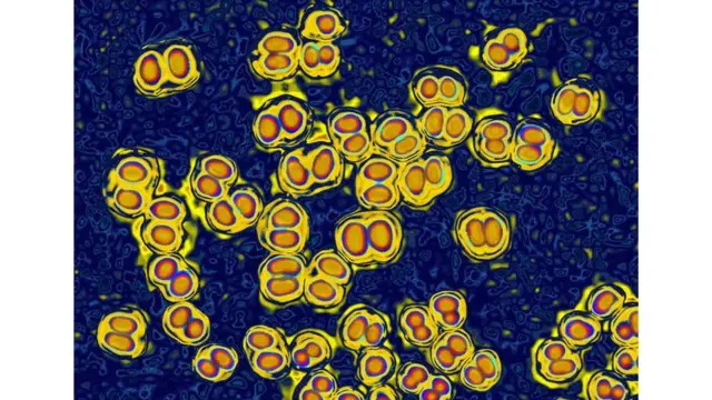 من الممكن الإصابة بسلالات معينة من البكتيريا التي تسبب التهاب السحايا حتى بعد تلقي اللقاح