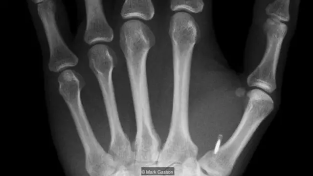 माइक्रोचिप