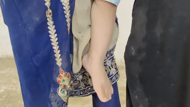 پولیو، محمد صالح