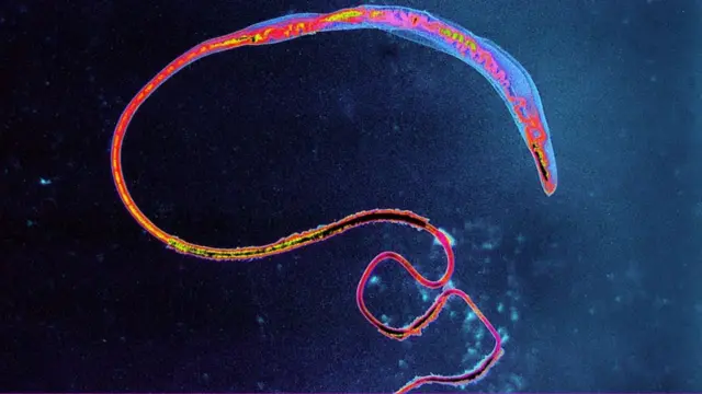 parasita