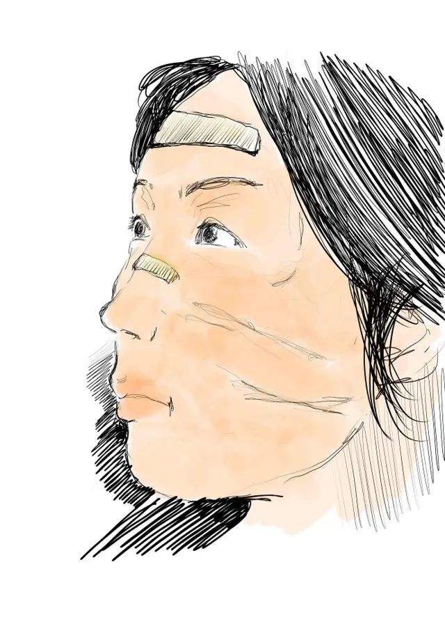 방호복과 마스크 탈의 후 의료진 얼굴에 테이핑과 자국이 선명하다. 사진 설명을 요청하자 오씨는 "방호복 탈의 이후의 간호사들의 모습이죠. 꾸밈없는 진실된 모습입니다"라고 말했다