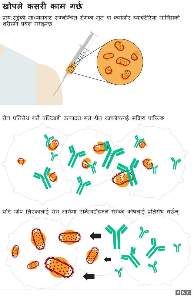 खोपको काम