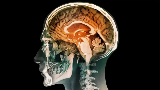 Le corpus callosum - l'arc orange sous le cerveau replié - facilite la communication entre les hémisphères du cerveau