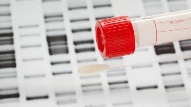 Tubo con muestra de ADN.