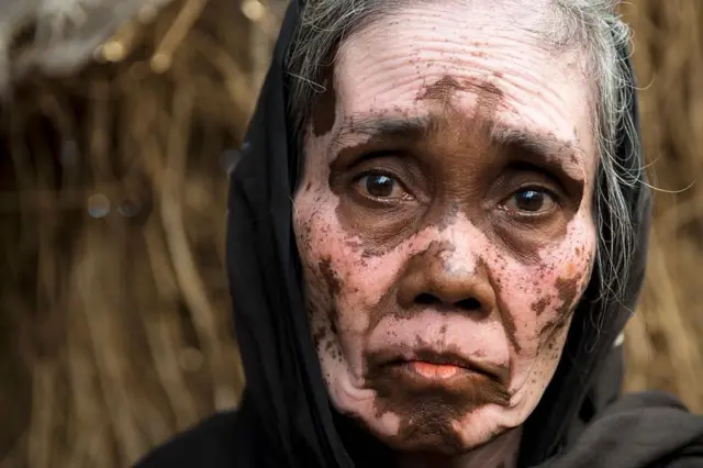 प्रातिनिधिक फोटो