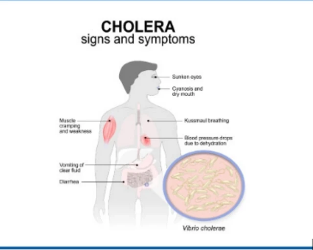 Aworan eya ara cholera