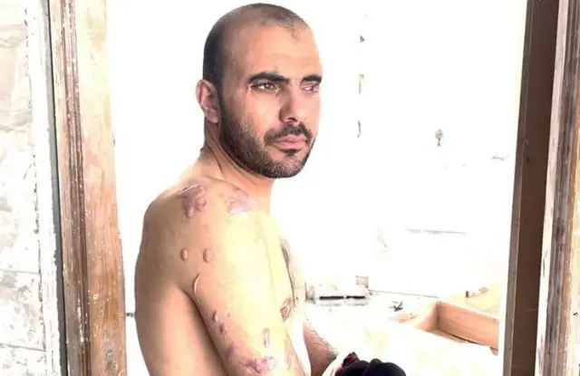 ایک مکینک محمد ابو طویلہ نے بتایا کہ انھیں کئی دنوں تک اذیت دی گئی۔ ان کا کہنا تھا کہ مارچ 2024 میں گرفتاری کے بعد فوجی انھیں ایک قریبی عمارت میں لے گئے جہاں تین دن تک وہ اکیلے قیدی تھے اور مسلسل فوجیوں کی تفتیش اور تشدد کا سامنا کرتے رہے۔