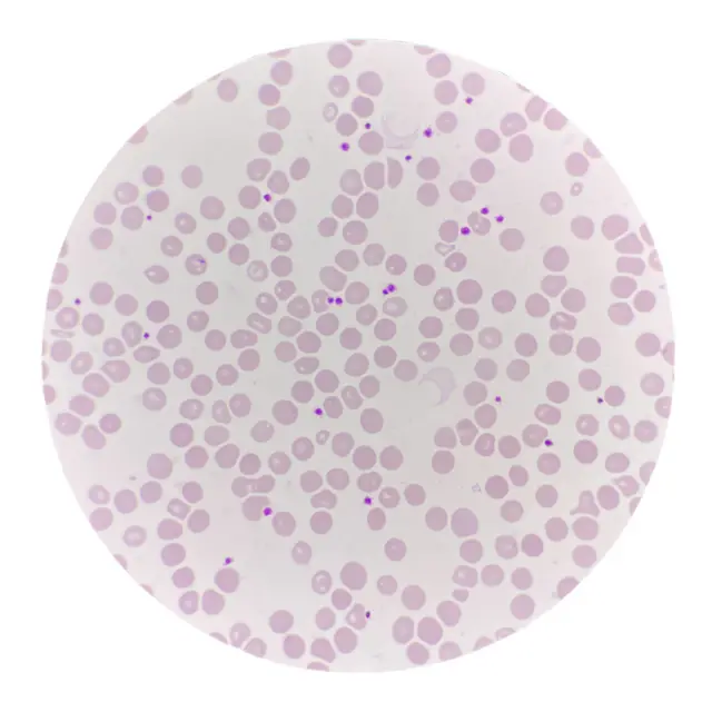 रक्तकोष र प्लेट्लट