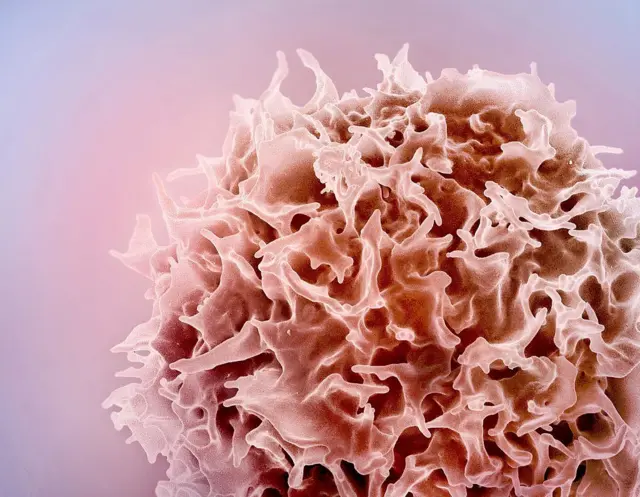 Una micrografía electrónica coloreada donde se ve una célula T o linfocito T. Su aspecto es como una esponja, con los bordes similares a pétalos de flores. 