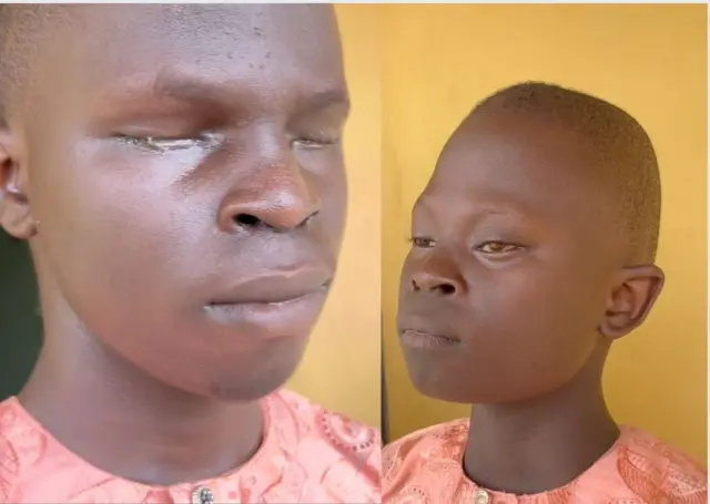 Awọn ọmọ Opeyemi ti ko riran