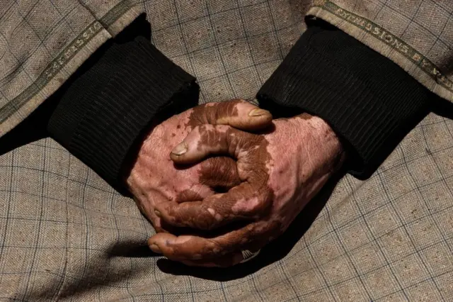 प्रातिनिधिक फोटो