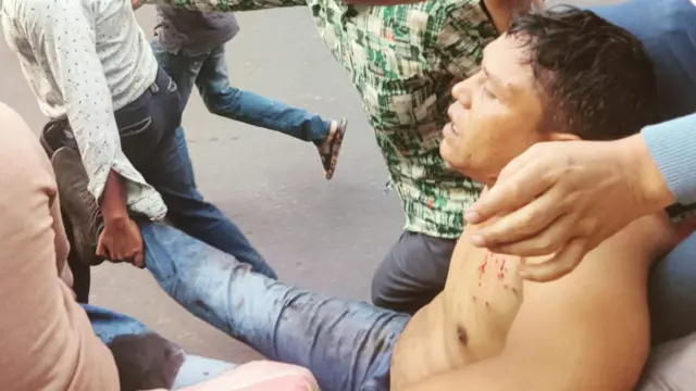 সংঘর্ষে আহত একজনকে উদ্ধার করে নিয়ে যাওয়া হচ্ছে