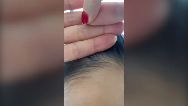 Foto de cabelo na testa