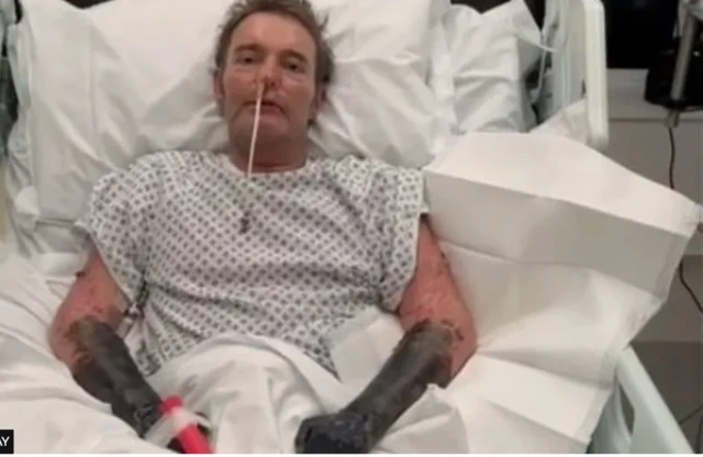 آقای مکینلی می‌گوید وقتی بعد از ۱۶ روز بهوش آمده دست‌ها و پاهایش را دیده است که به رنگ سیاه درآمده بود، و انگار از جنس پلاستیک بوده. پزشکان به او می گویند باید پاها و دست‌هایش راقطع کنند