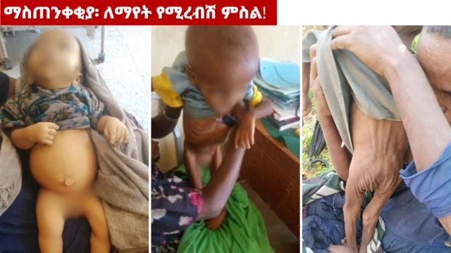 በአማራ ክልል ሰሜን ወሎ ዞን ቡግና ወረዳ በምግብ አጥረት የተጎዱ ጨቅላ ሕፃናት 