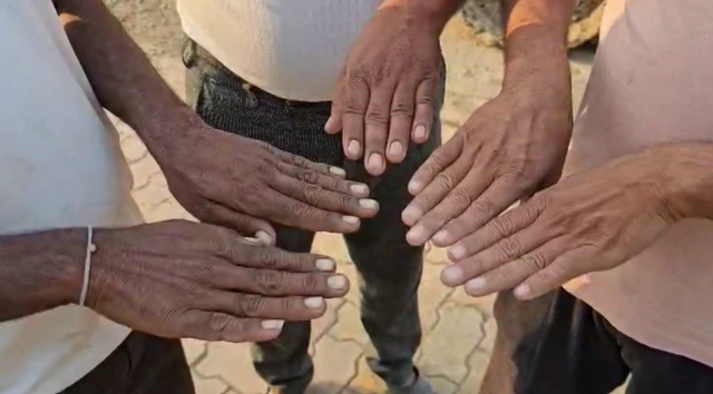 बुलढाणा नखगळती