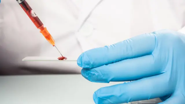 एबीओ ही रक्ताचं वर्गीकरण करणाऱ्या अनेक प्रणालींपैकी एक आहे. (प्रातिनिधिक छायाचित्र)