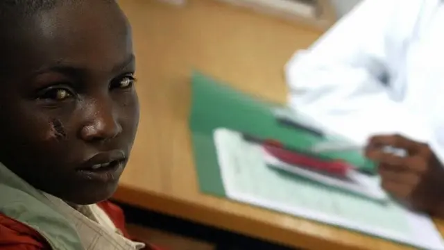 ወቕዒ ስዒቡ ስብራት፡ ቁስለትን ካልኦት ኣካለዊ መጉዳእቲን ከጋጥም ዝያዳ ተኽእሎ ኣሎ