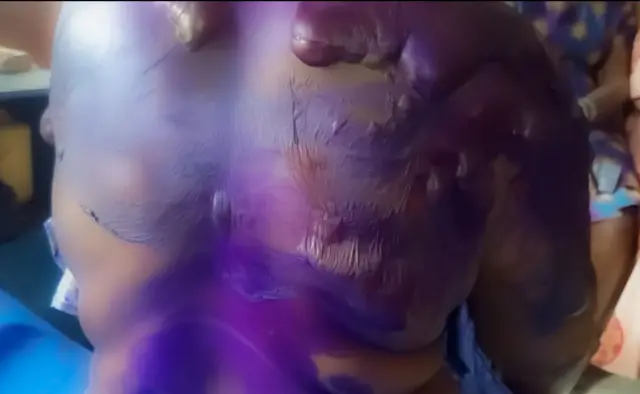 Nwoke e huru mmiri ọkụ