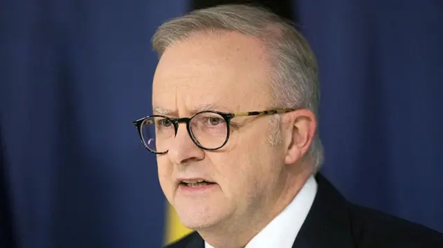 एंथनी अल्बनीज़