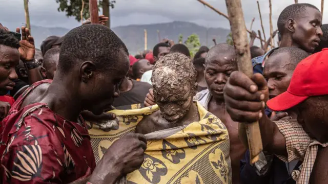ختان طفل من قبائل الباغيسو في أوغاندا 