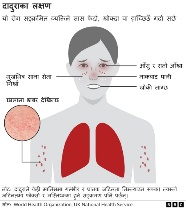 दादुराका लक्षण