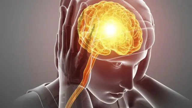 Hormones dey play important role for di development of migraines.