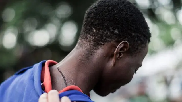 Foreigner wey wunjure for xenophobic attack