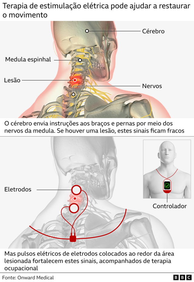 Infográfico mostra como funciona a terapia